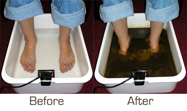Ionic Foot Bath