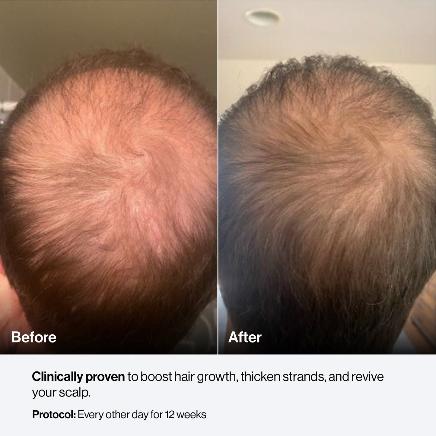 Celluma PRO